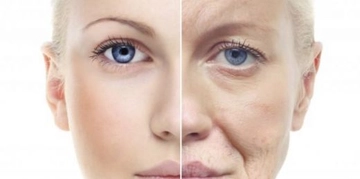 Salyangoz Kremi Sivilce Kullanımı ve Faydaları Nelerdir?